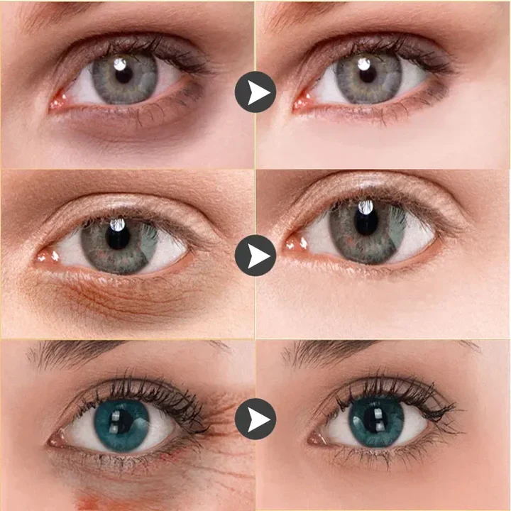 Intense Eye Revive - Special Offer - Image 6